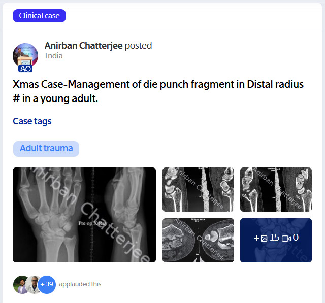 myAO case trauma