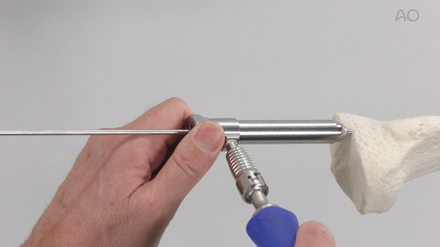 AO Foundation educational videos