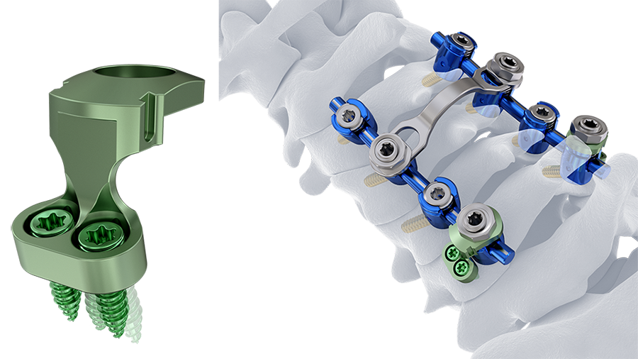 Symphony OCT Compartment 2