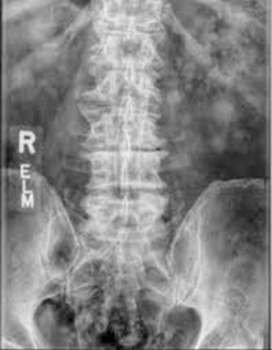 lumbar fig5