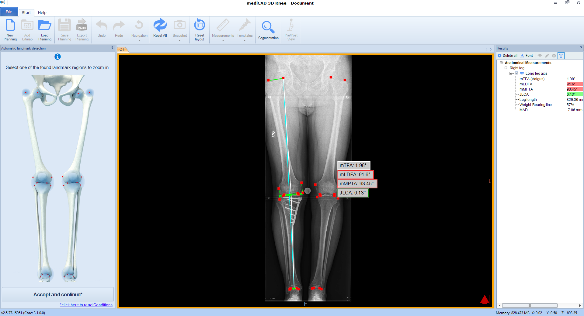 case 2 post analysis