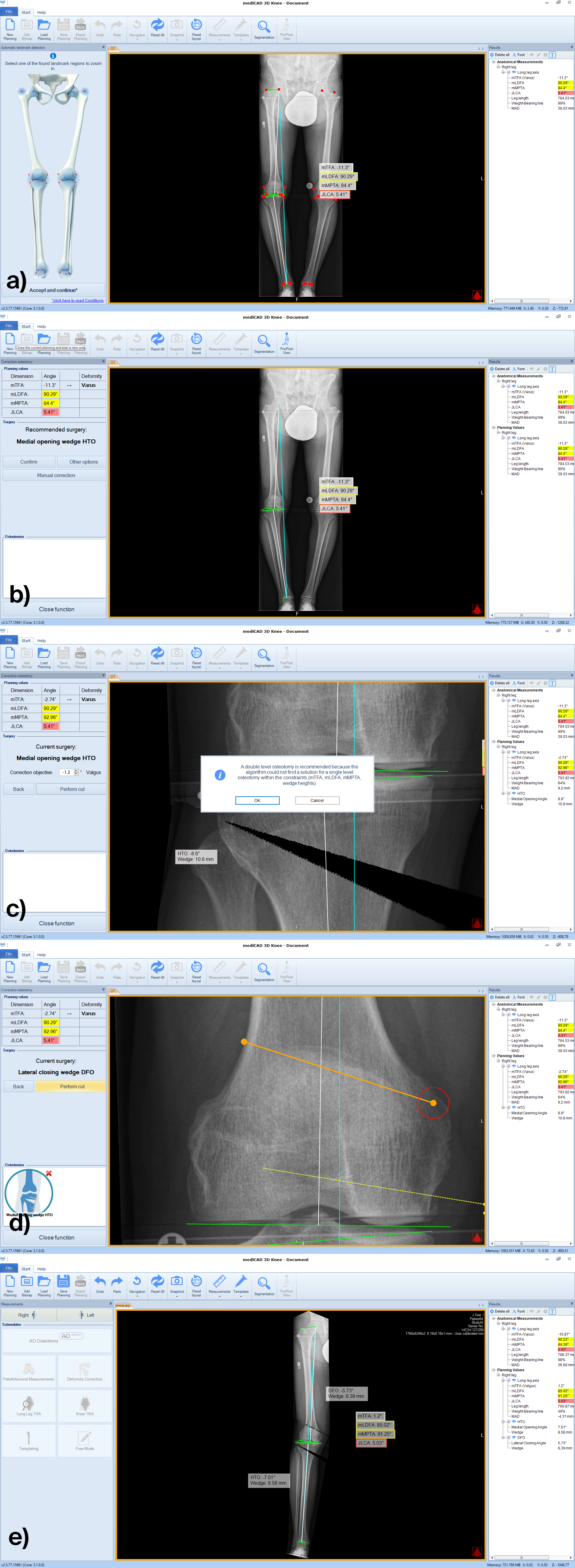 case 3 workflow