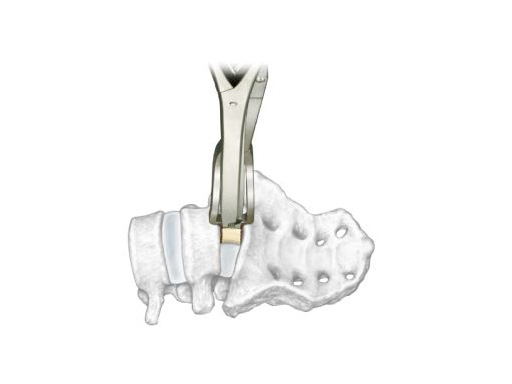 alif_spacer_instruments_1