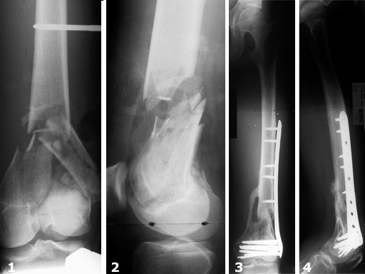 liss_study_results_1