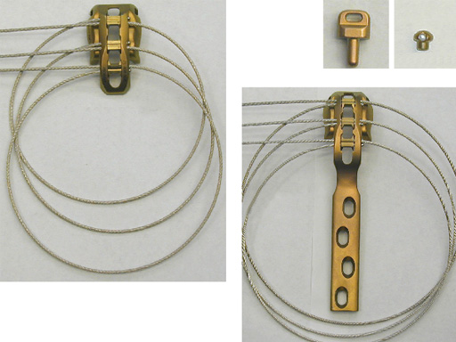 ortho_cable_sys_pahse_2_1