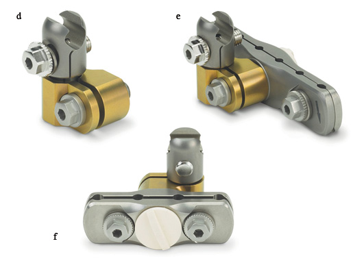 medium-ex-fix-add-clamps-02