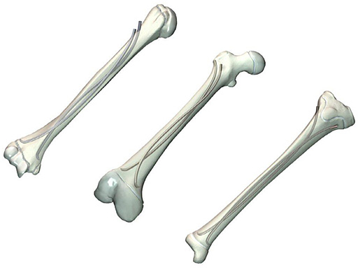 stailness_steel_elastic_nail_STEN