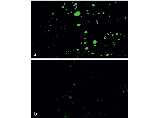 ria_vs_unreamed_nail_1