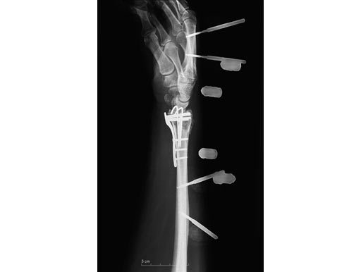 UG-053322-05-10-Januar-06