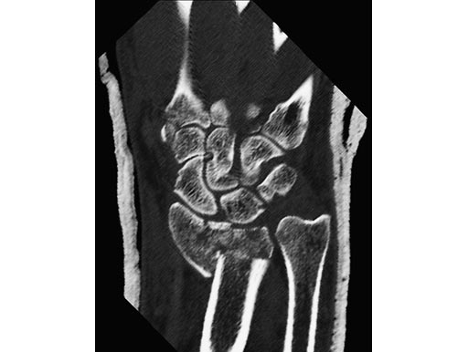 UG-053322-05-3106-ap-CT1