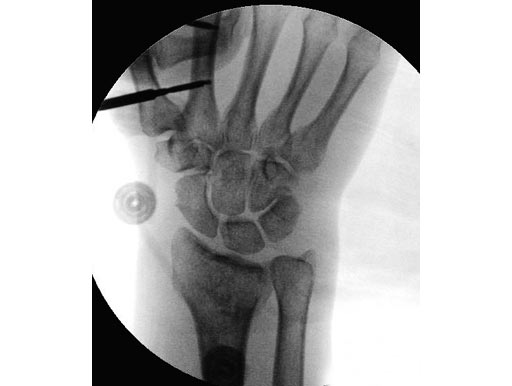 UG-053322-05-OP1-Bildwandle