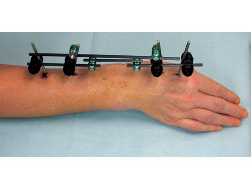 UG-053322-05-postop-klin-2