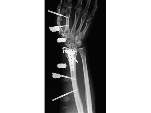 UG-053322-05-RO-10-Januar-0