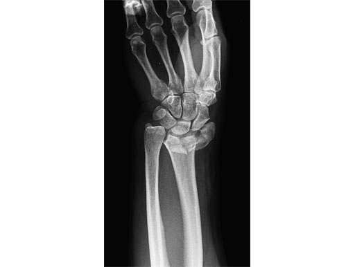 UG-053322-05-RO-10-Januar-1