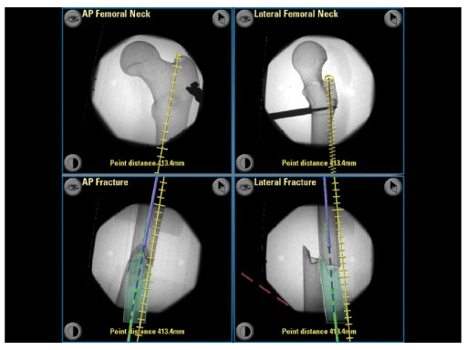 Axis_Reduction_and_Alignment_Module_2