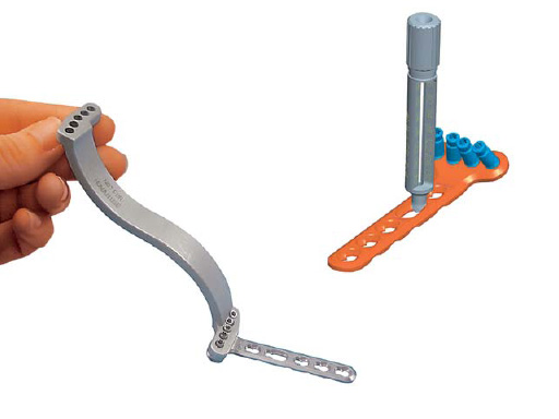 extraarticular_volar_dr_1