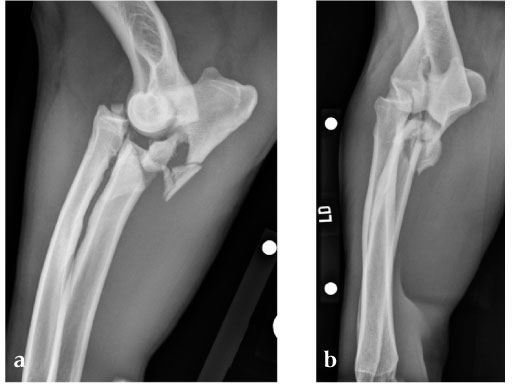 LCP_Broad_Plate_3-5_2