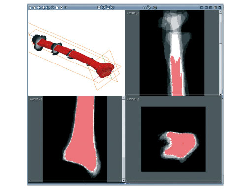 LCP_MetaDiaphyseal_Vol_DR_Plate_6