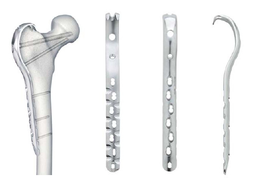 LCP_Proximal_Femoral_Hook_Plate-4_5_1