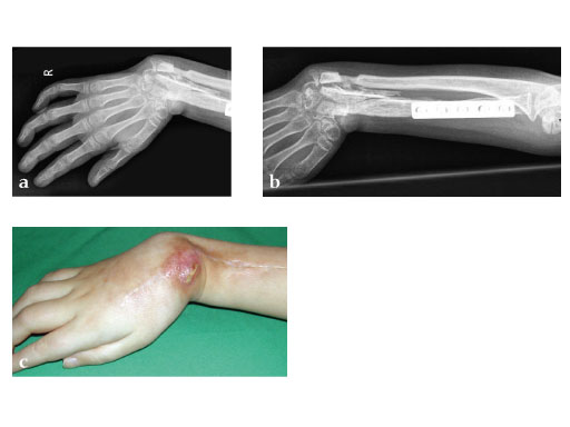 Modular_Mini_Fragment_LCP_2-1_2-4_2-7_3