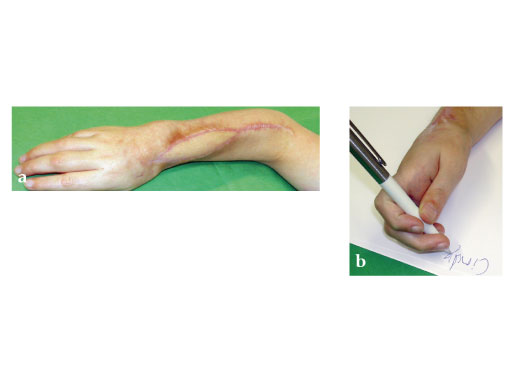 Modular_Mini_Fragment_LCP_2-1_2-4_2-7_7