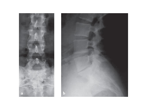 ProDisc-L-ProDisc-C_5