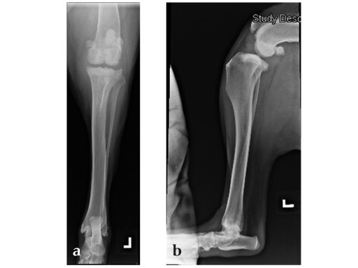 Tibia_Plateau_Leveling_Osteotomy_Plate_new_1
