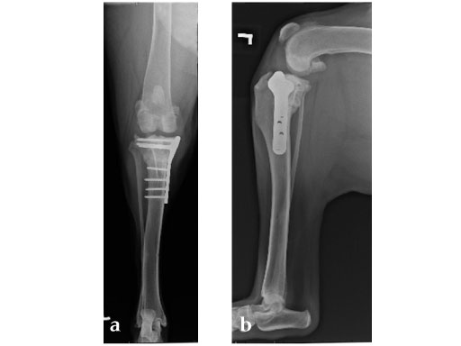 Tibia_Plateau_Leveling_Osteotomy_Plate_new_3