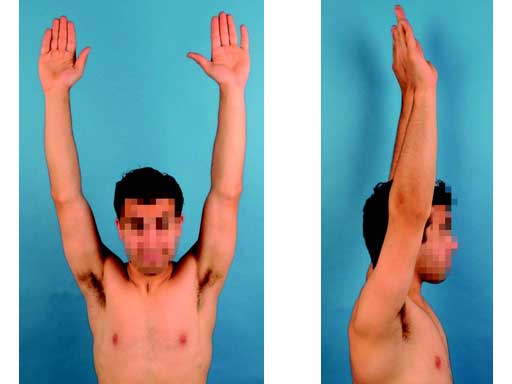 LCPSuperiorAnteriorClavicle_8