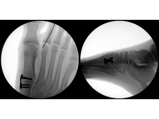 LockingXPlate_2-4_2-7_ExtraSmall_3