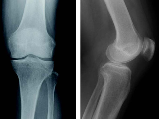 TomoFixHTOSmallStatureAsianVersion_2