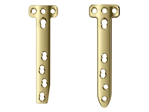 TomoFixMedialHighTibia_2