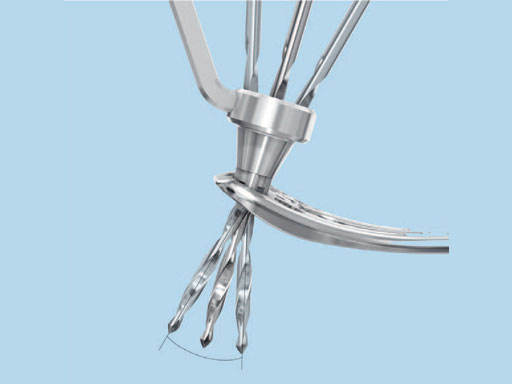 VariableAngleLCPDistalRadiusSystem2-4_3