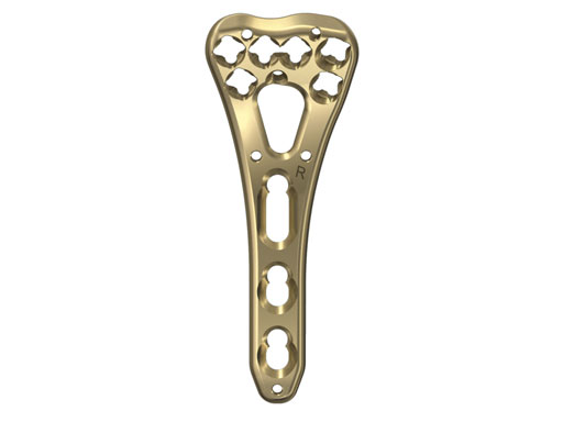 2-4mmVA-LCPTwo-ColumnVolarDistalRadiusNarrowforSmallStature_1