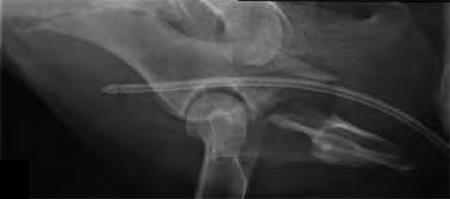 3-5mmLC-DCP_and_LCP_Fig3