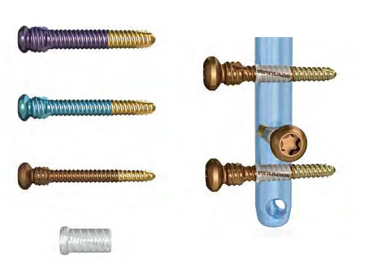 AngularStableLockingofIntramedullaryNailsASLS_1