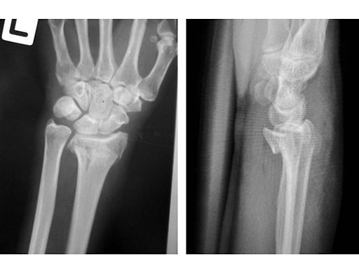 case-two-col-volar-dr-01