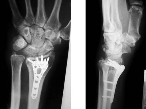 case-two-col-volar-dr-02