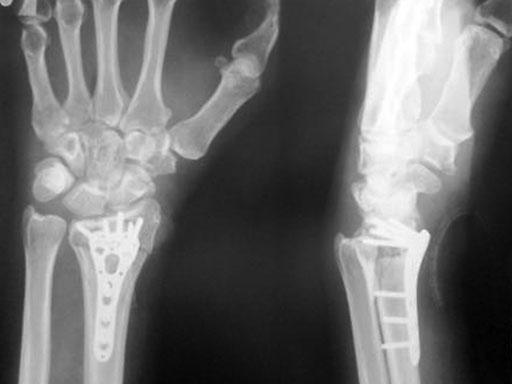 case-two-col-volar-dr-03