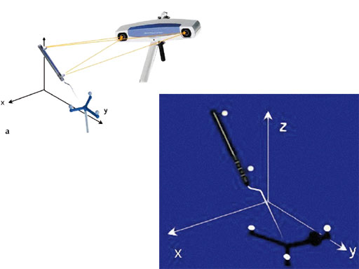 computer-ass-spinal-surgery-01