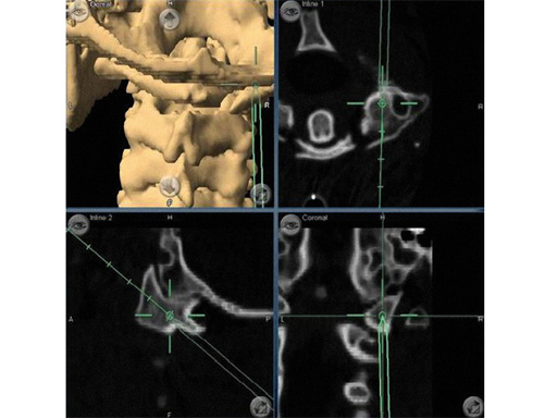computer-ass-spinal-surgery-09