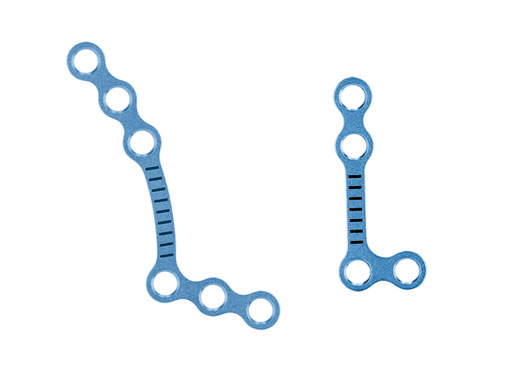 MatrixOrthognathicSystem_1