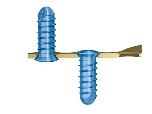 MatrixOrthognathicSystem_10