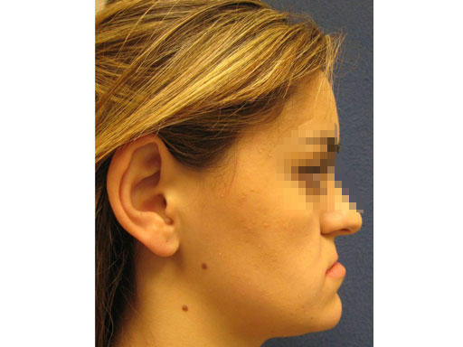 MatrixOrthognathicSystem_13