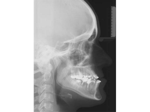 MatrixOrthognathicSystem_14