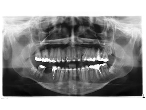 MatrixOrthognathicSystem_15