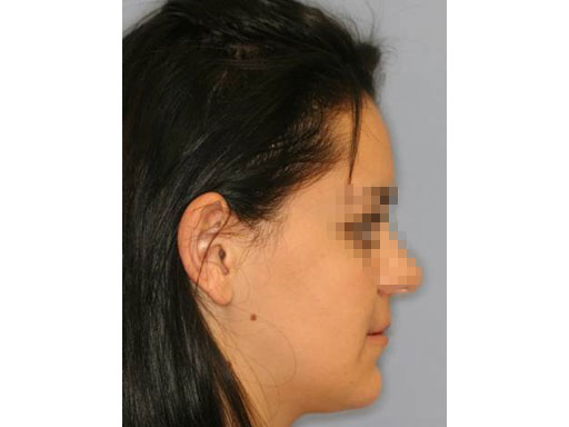 MatrixOrthognathicSystem_16