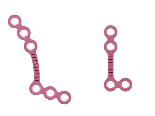 MatrixOrthognathicSystem_2