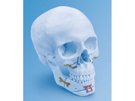 MatrixOrthognathicSystem_4