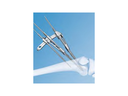 OsteotomyGuidingDevice_1